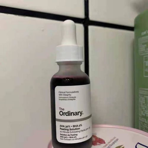 sonhar que ganha dinheiro_sonhar morcego_sonhar com varios dente caindo